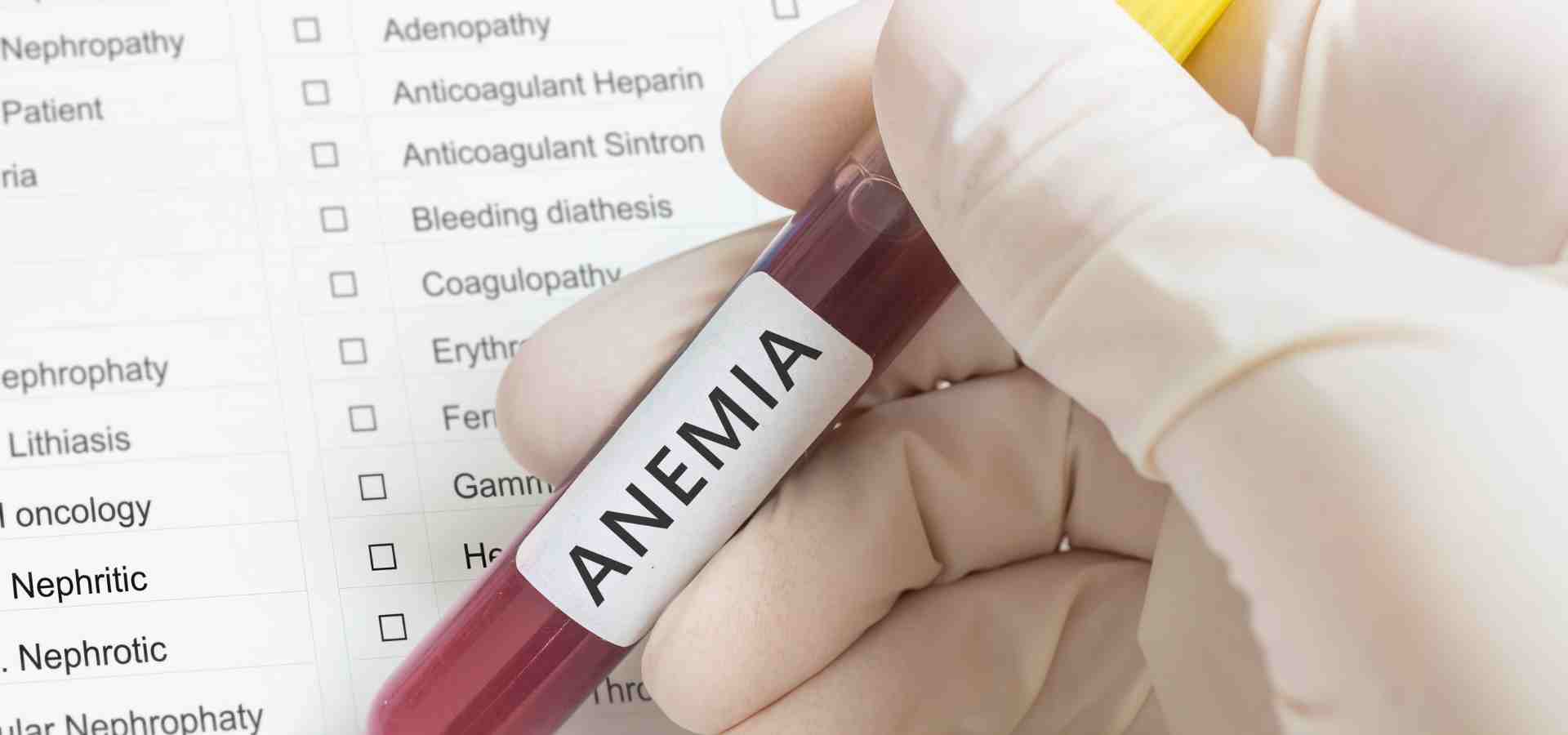 Anemia: Causas, Sintomas e Estratégias de Tratamento